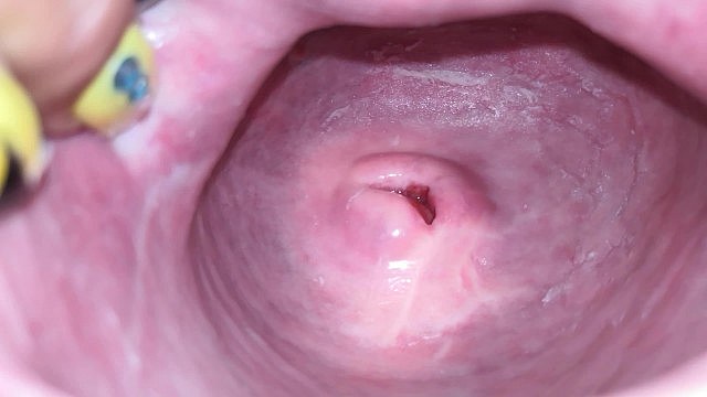 Cervix Up Close and Personal